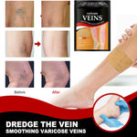 Pack 36 Parches Para El Cuidado De Las Venas