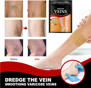 Pack 36 Parches Para El Cuidado De Las Venas
